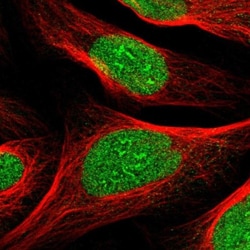 ZNF297B Antibody, Novus Biologicals 25 &mu;L, Unlabeled:Antibodies, Polyclonal